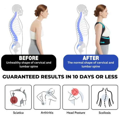 🔥Flash Sale 49% OFF-Posture Corrector-Back Brace for Men and Women- Fully Adjustable Straightener